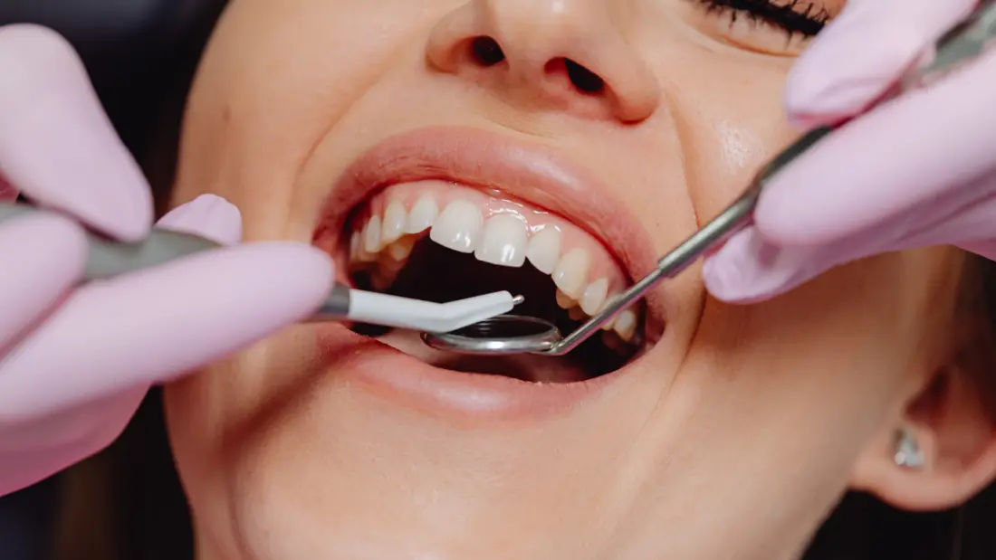 Koliko traje oporavak nakon ugradnje implantata?