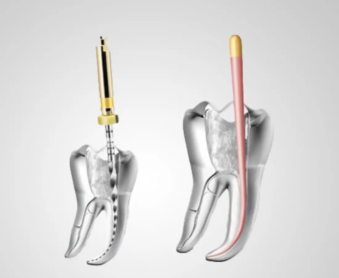 Endodoncija