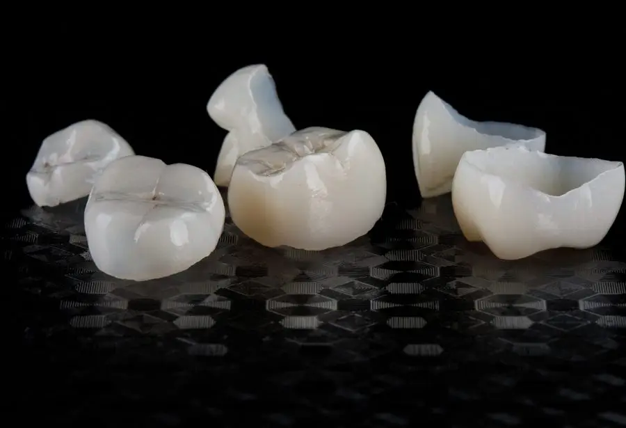 Stomatološka protetika i implantoprotetika u Family Dental Centru